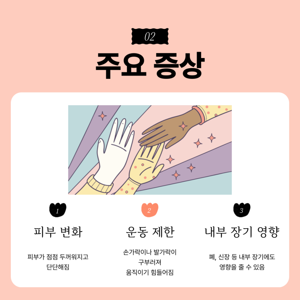 003-1 전신경화증, 희귀병이지만 희망이 있다? 성슐랭 가이드가 소개하는 지방유래 줄기세포 치료의 가능성 | SC301의원