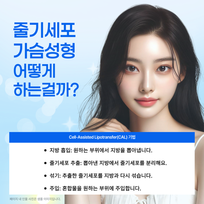 003 지방유래 줄기세포 가슴성형, 기존 방식과 뭐가 다를까?
