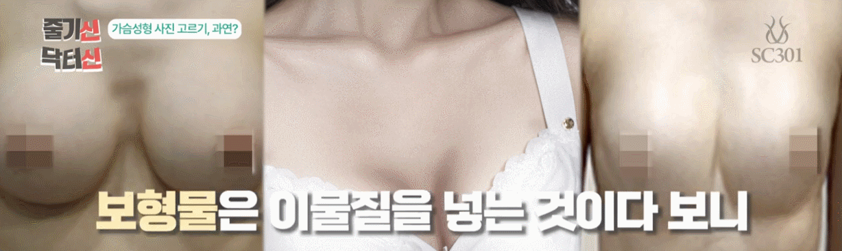 보형물_촉감이_다를_수_밖에_없습니다 보형물 대신 SVF 가슴성형을 선택하는 이유