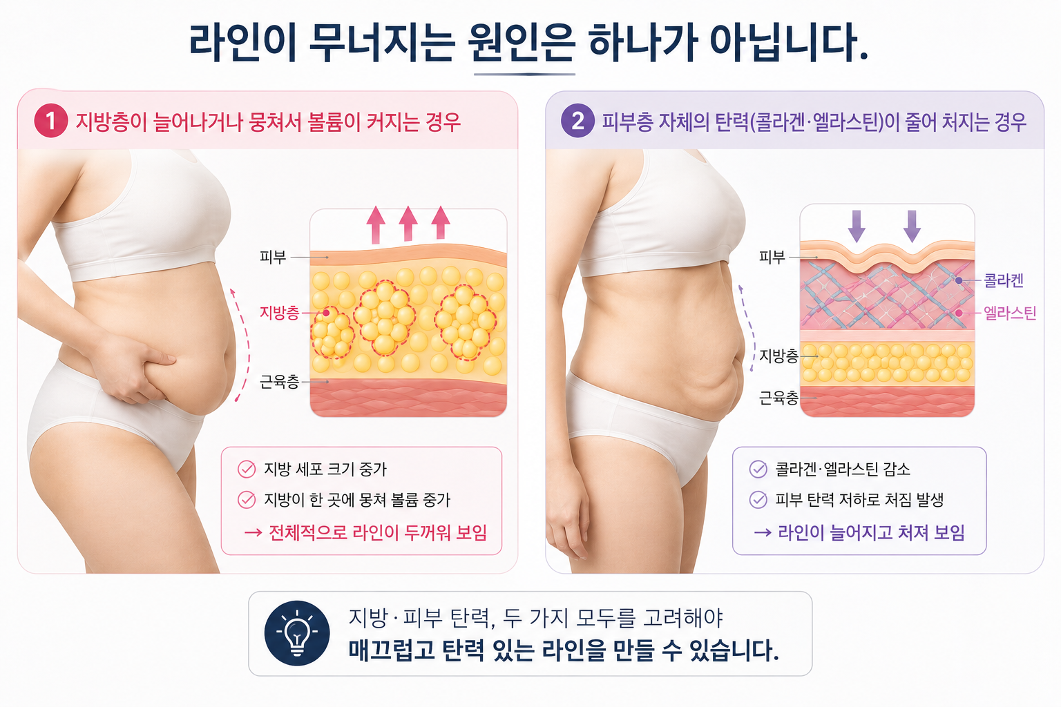 3aa5a960-01f5-40d3-a6a5-671b4d976c59 울더마 & 코레지 — 지방과 탄력을 나눠서 관리하는 비수술 프로그램