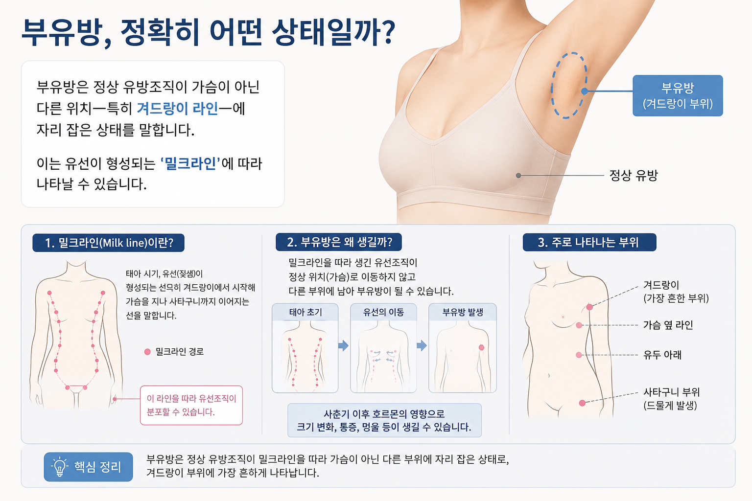 46ca95ac-69ff-4288-9ff1-48bc774b9800 부유방과 밀크라인 — 발생 원리부터 수술 접근법까지
