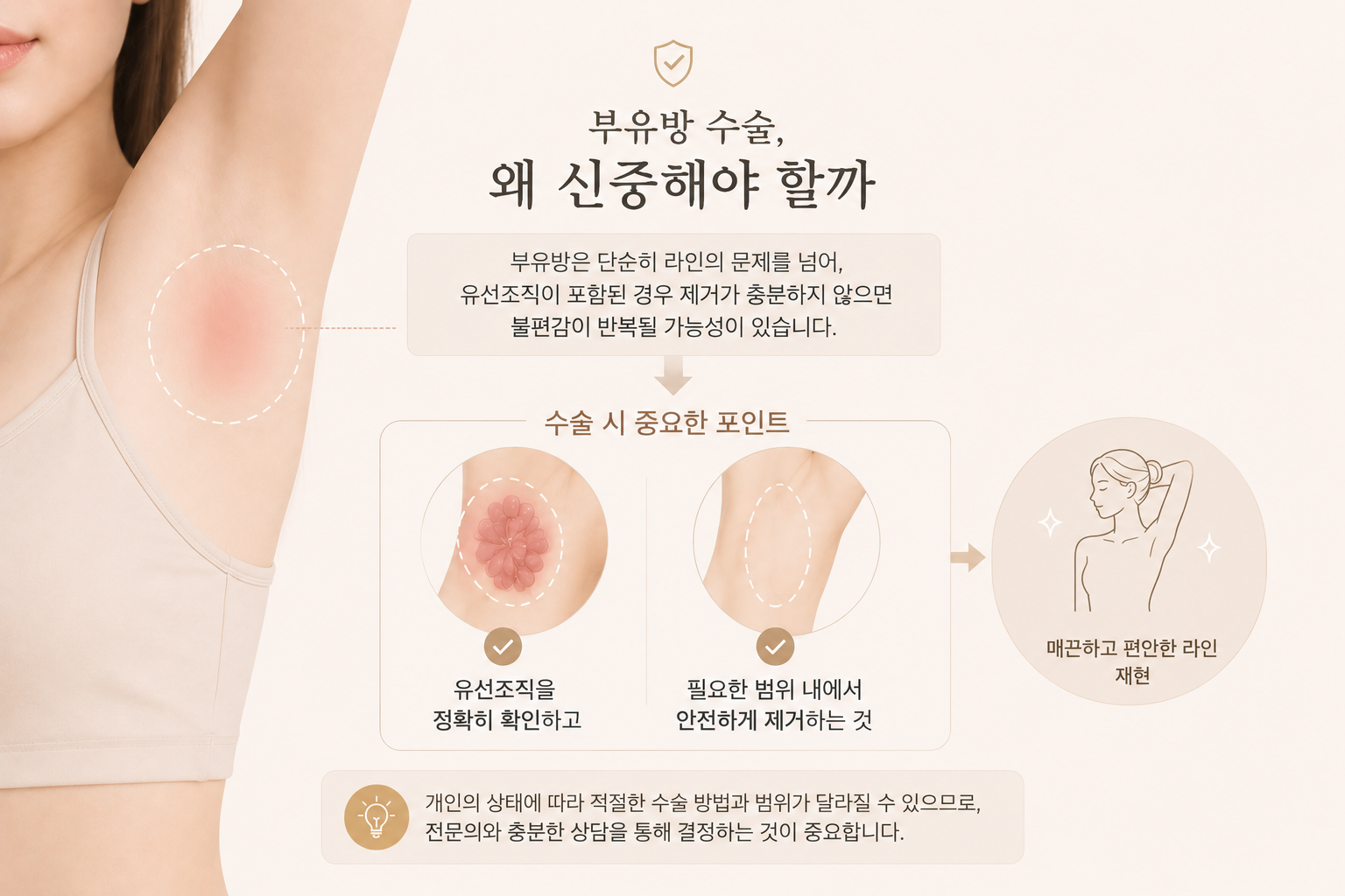 image-2 부유방 — 자가진단부터재수술없는수술계획, 가슴라인개선까지