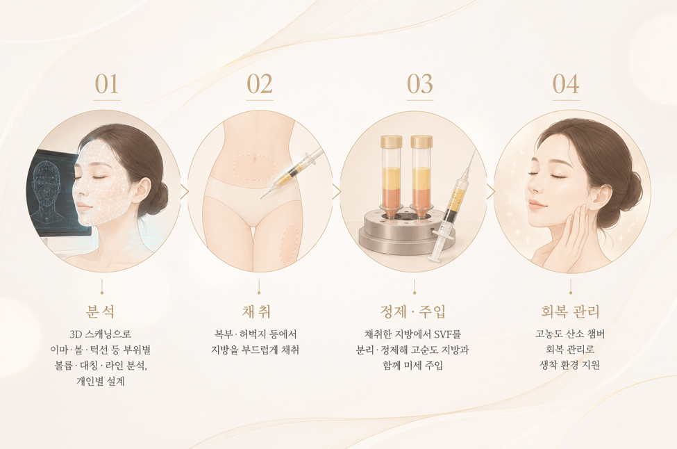 ss SVF 얼굴 지방이식이란: 정의부터 생착률, 시술 과정, 부작용까지
