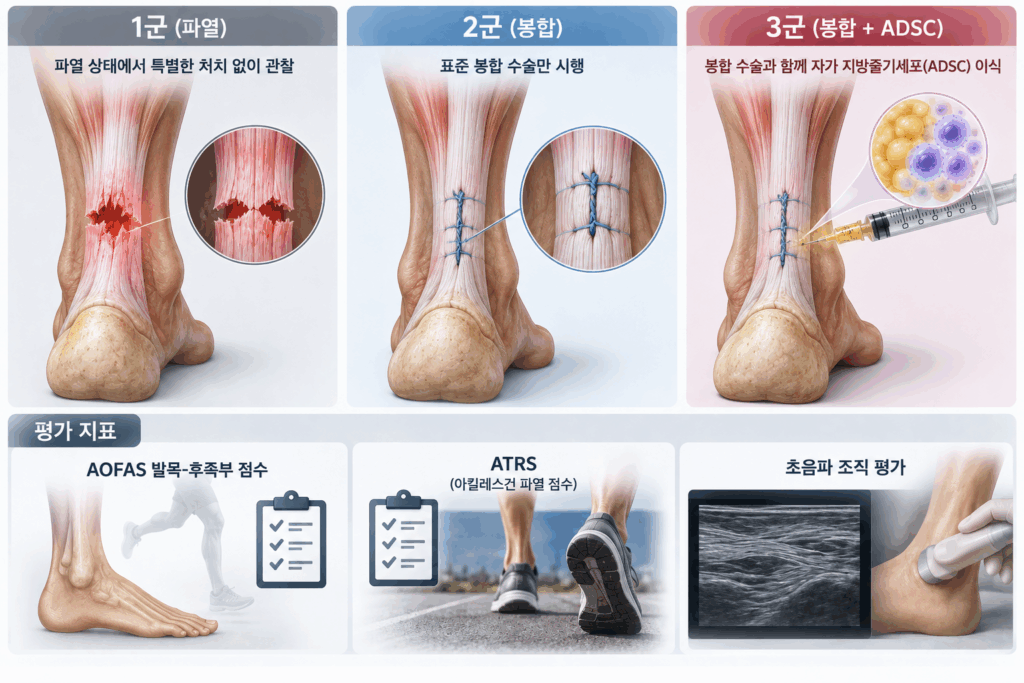 아킬레스건-치료군과-평가-지표-1024x683 끊어진 아킬레스건, 세포치료로 회복력을 더하다