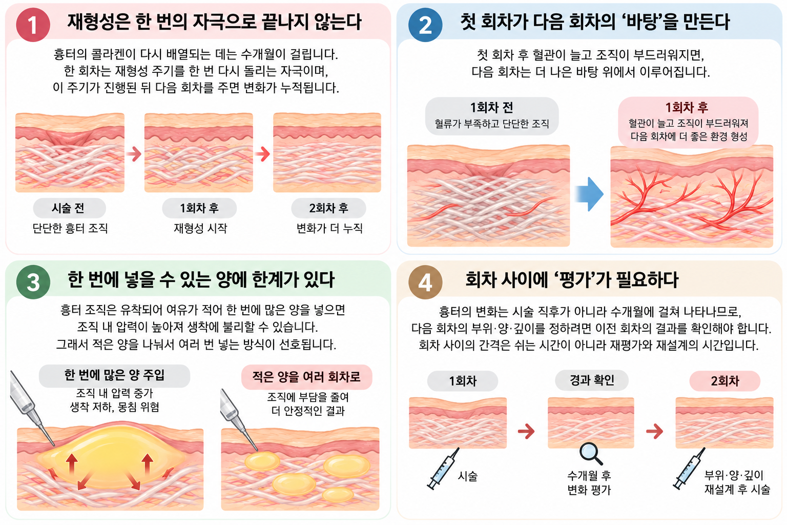 흉터치료를-다회차로-하는-이유 흉터 재생치료가 여러 회로 나뉘는 이유 — SVF와 흉터 조직의 재형성 시간