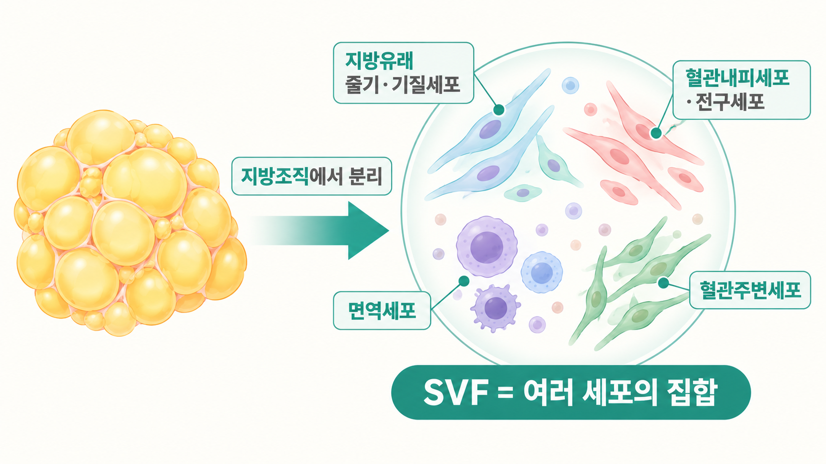 SVF를-이루는-세포-구성 셀핏리프팅, 꺼진 곳은 채우고 처진 곳은 당기는 원리 — 볼륨과 리프팅을 함께 설계하는 이유