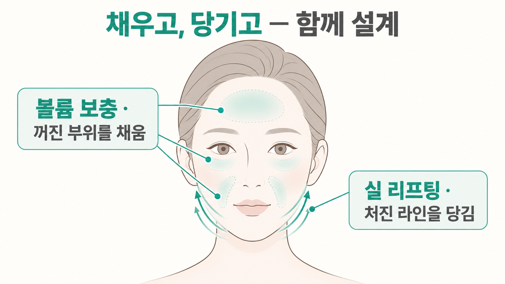 채우기와-당기기 셀핏리프팅, 꺼진 곳은 채우고 처진 곳은 당기는 원리 — 볼륨과 리프팅을 함께 설계하는 이유