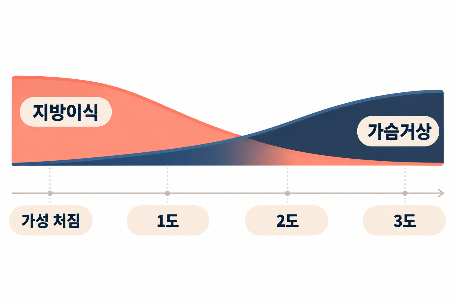 처짐-정도와-지방이식의-비중 '처진 가슴, 지방이식만으로 올라갈까? — 처짐 단계별로 보는 가슴거상과 지방이식의 역할'